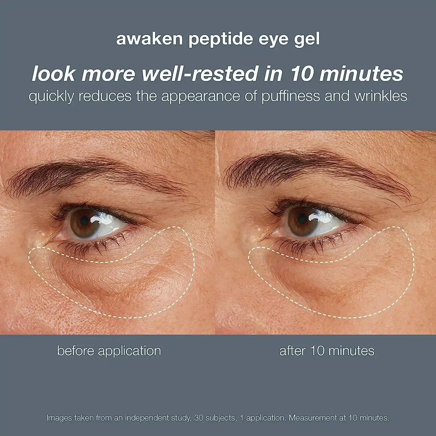 Dermalogica Awaken Peptide Eye Gel 15 Ml