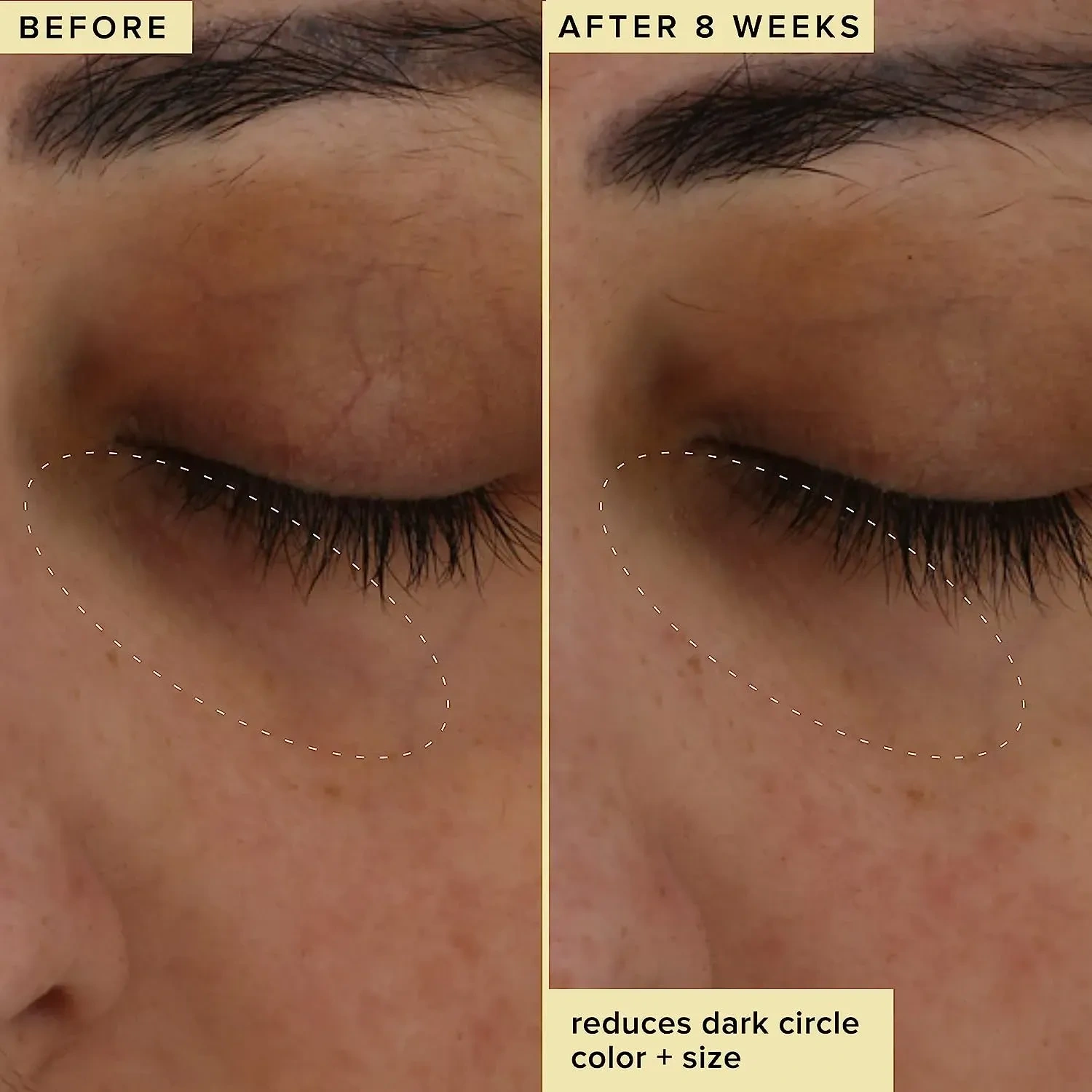 Farmacy Wake Up Honey Eye Cream Formulated With Caffeine & Vitamin C