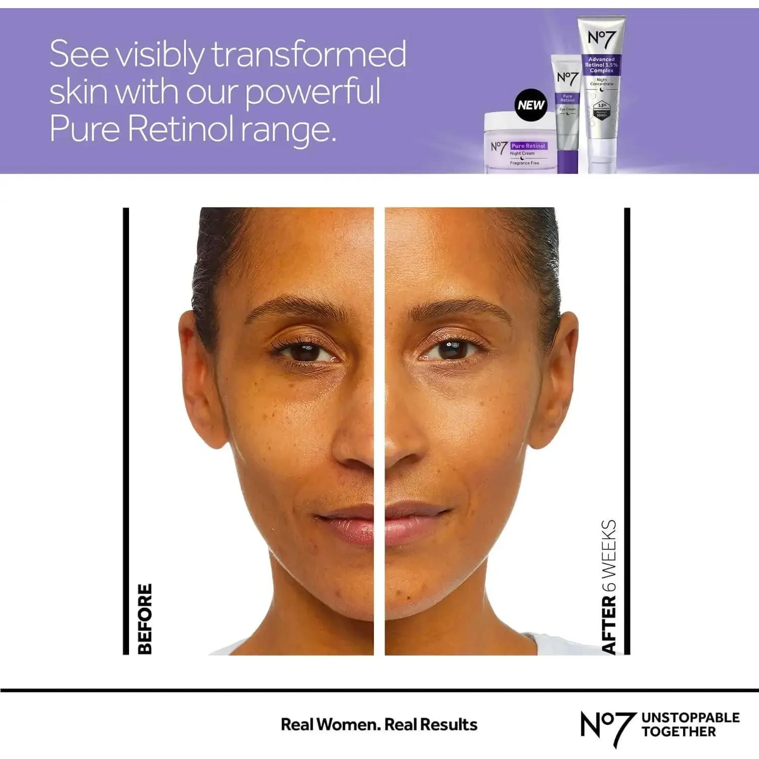 No.7 Pure Retinol Eye Cream - 0.5Oz
