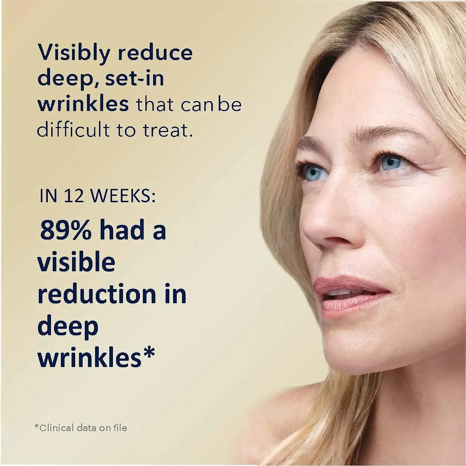 Roc Retinol Correxion Deep Wrinkle Facial Serum, Anti-Wrinkle Treatment Made With Retinol, 1 Fl. Oz
